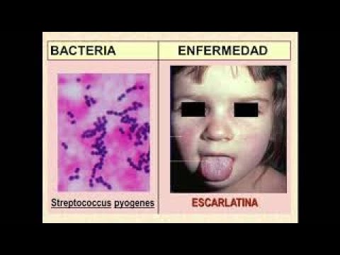20 enfermedades causadas por bacterias